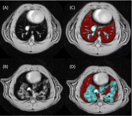 Cross sectional images during MRI